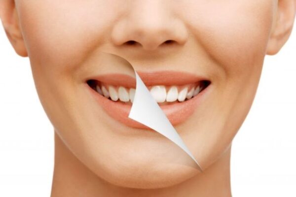 The Life-Changing Benefits of Full Smile Restoration