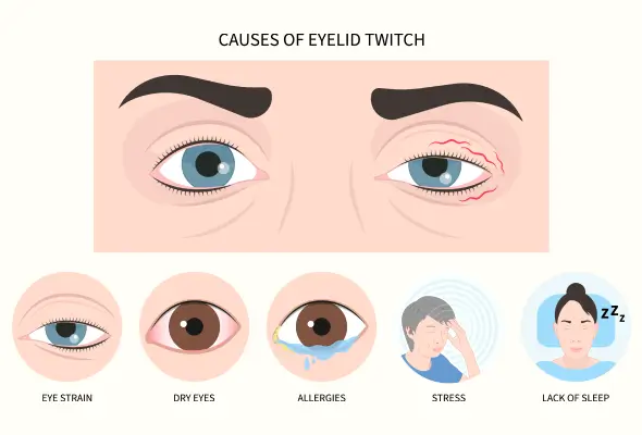Woman experiencing right eye twitching due to stress or fatigue